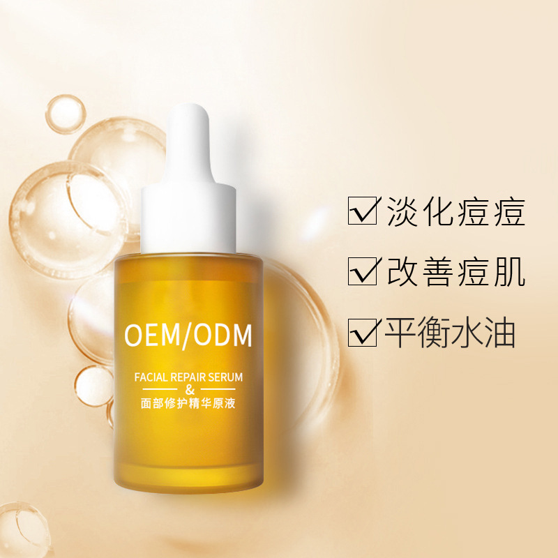 博尔塔拉蒙古自治州_祛痘精华原液OEM